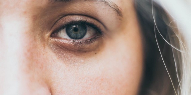 Comment faire disparaître les cernes avec l'huile de ricin ?